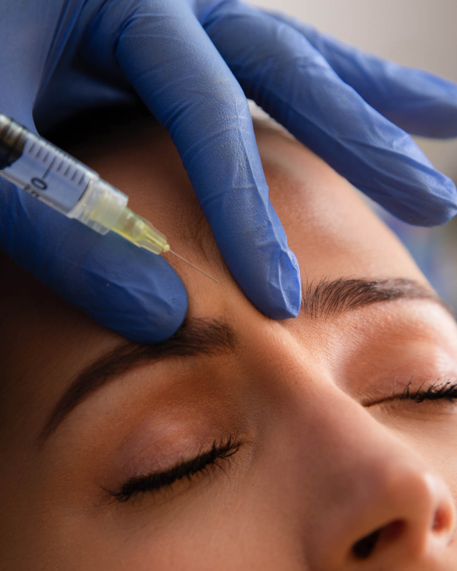 BOTOX® Treatment