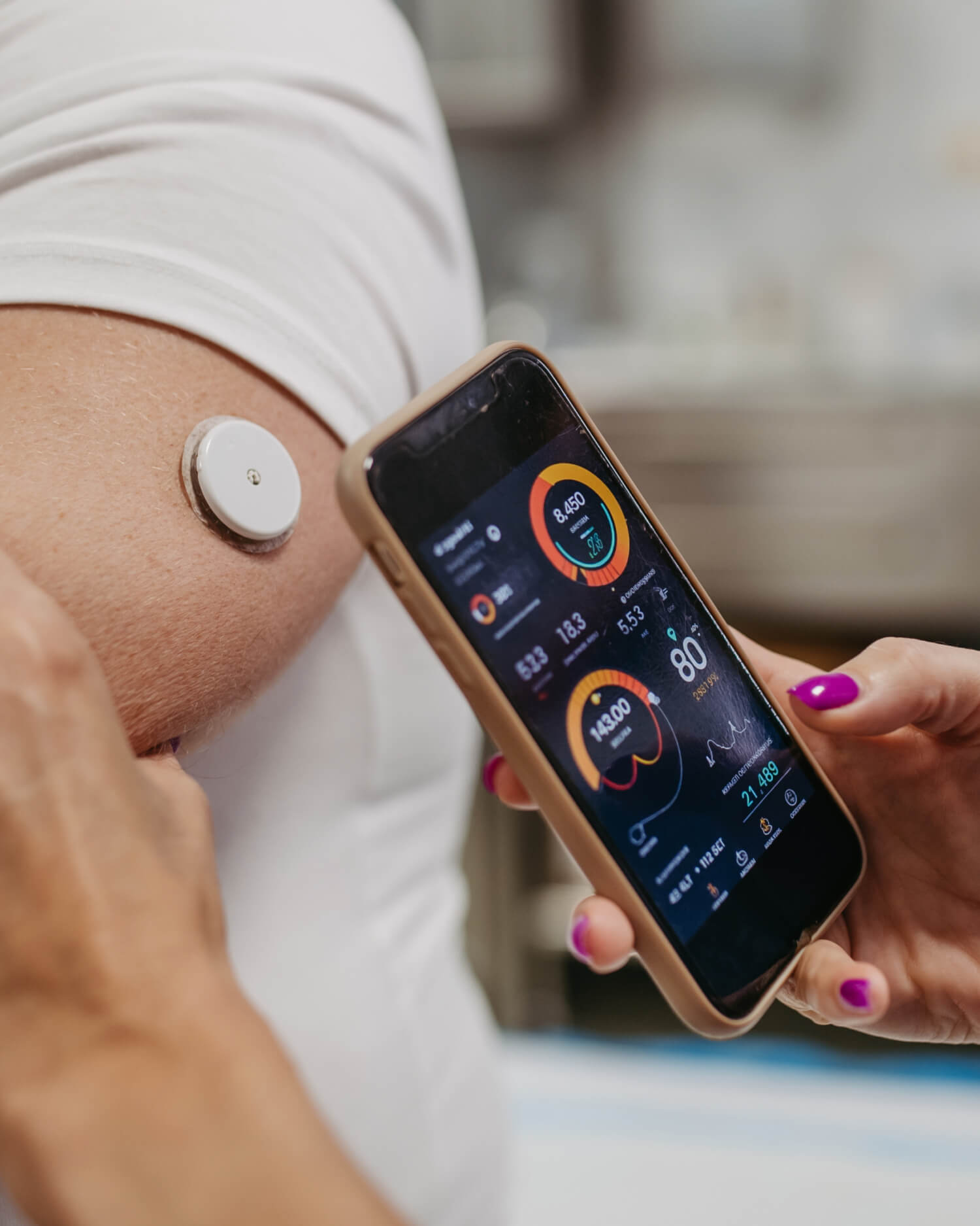 Continuous Glucose Monitor Application and Education — 25 min