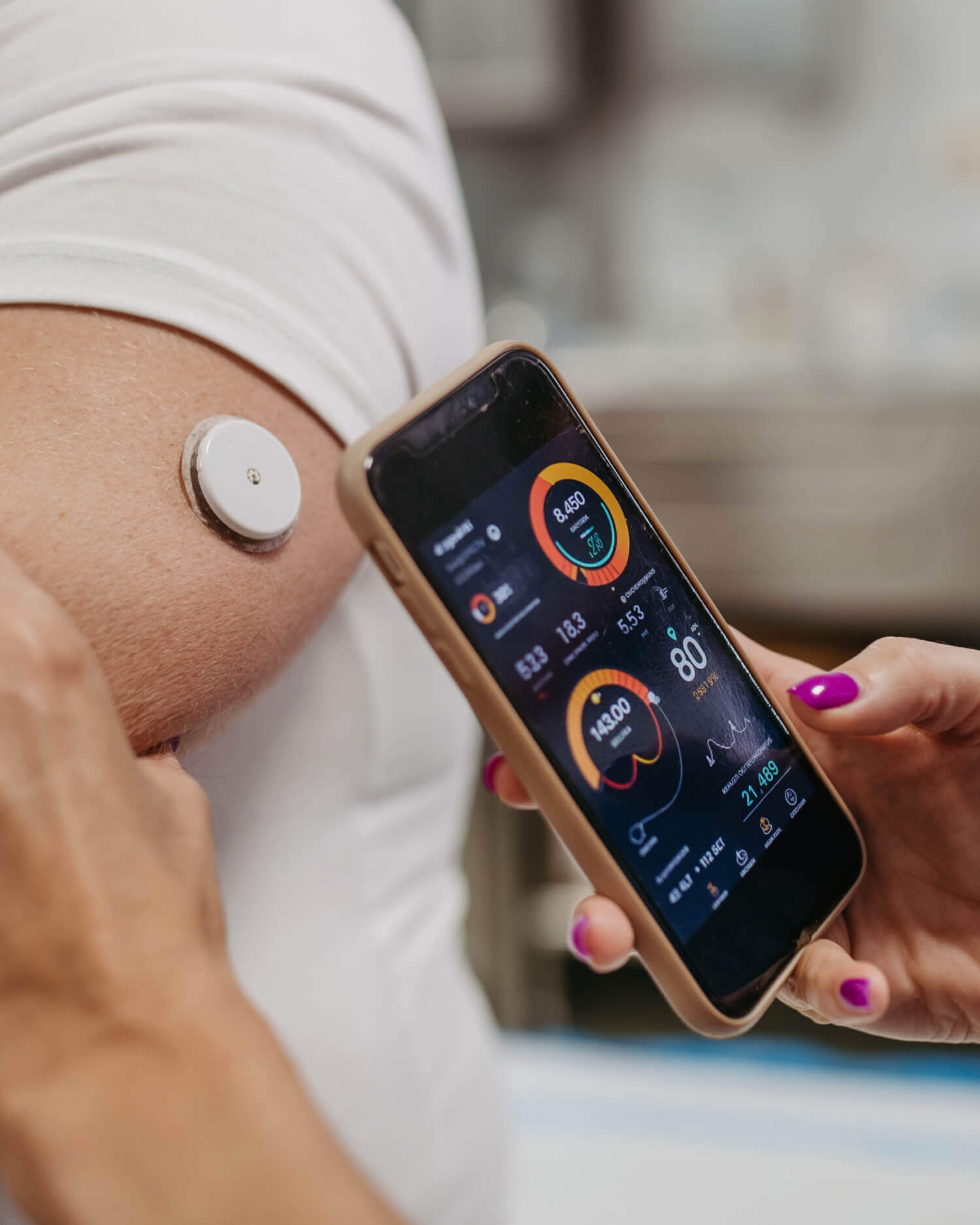 A person with a glucose monitor
