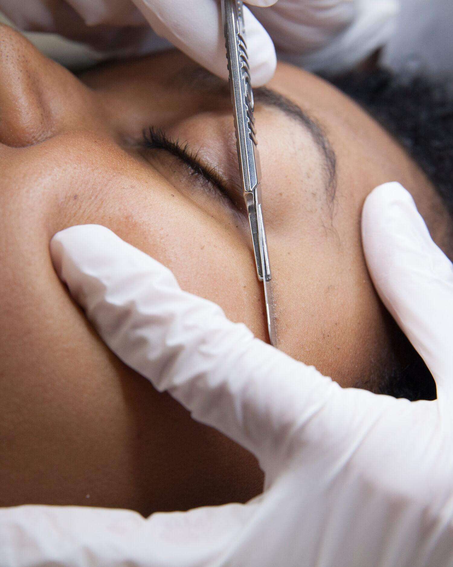 Dermaplane